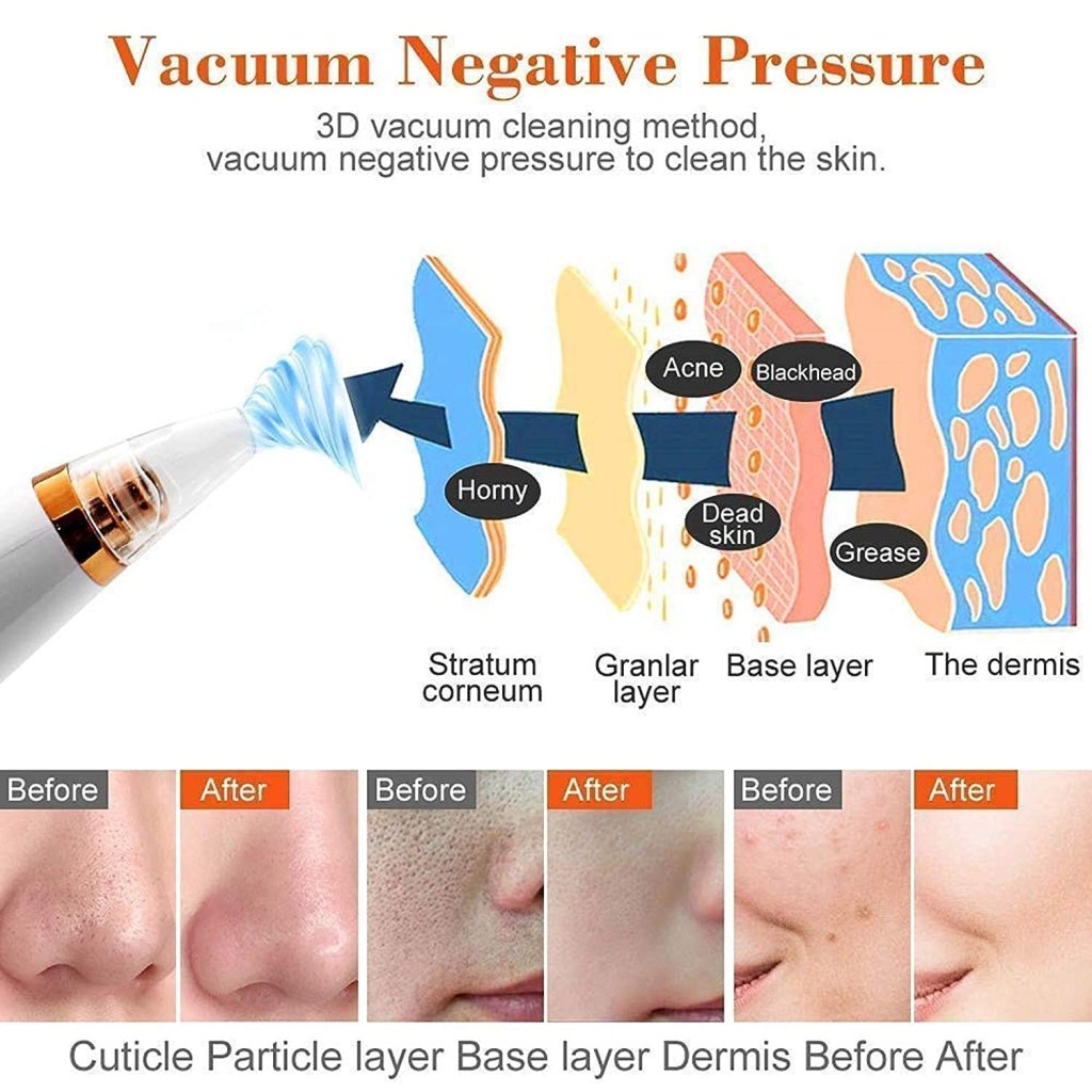 Diagram showing the use of vacuum negative pressure for skin cleaning with before and after results.