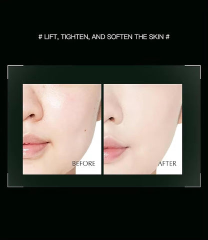 Before and after comparison of skin treatment with text '# Lift, Tighten, and Soften the Skin #'.